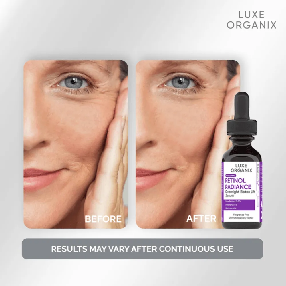 Luxe Organix Retinol Radiance Overnight Botox Lift Serum - 30ml